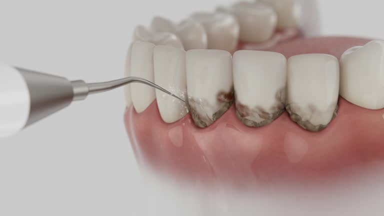 Trusted Dental Implants service in Crystal River, FL - Dentist Open Now
